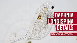 Daphnia Longispina details | by Motic Europe