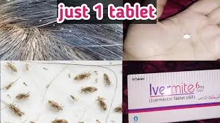 anti lice tablet|ivermite 6mg tablet for lice |ivermectin|lice and nits removal| #jannatsbeauty