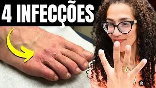 Coceira na Pele: 4 Infec&ccedil;&otilde;es Que Podem Ser a Causa
