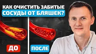 ЭТИ симптомы говорят о ЗАБИТЫХ сосудах ног! Как БЫСТРО очистить тело от БЛЯШЕК?! Советы от доктора!