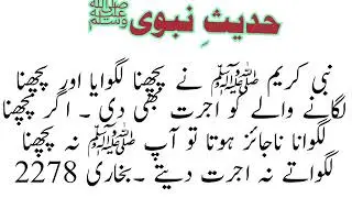 hijama lagana mazdori hadeed nabvi #hadeesenabvi #hijama #hadeesmubarak #urduhadees #hadith   #hadit