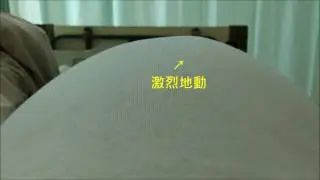 201612 剖腹產前晚寶寶胎動