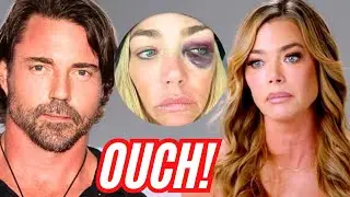 DENISE RICHARDS SHARES HORRIFYING PHOTOS IN RESTRAINING ORDER AGAINST EX!