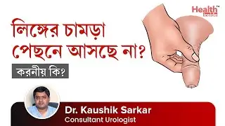 ফাইমোসিস রোগের চিকিৎসা | সারকামসিসন | Tight Foreskin or Phimosis Treatment | Circumcision Surgery