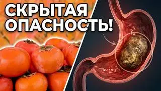 Хурма: Как избежать проблем? Советы опытного хирурга