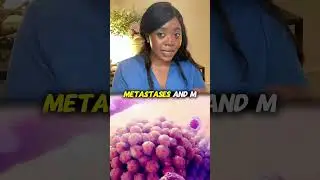 How Doctors Determine Cancer Stage