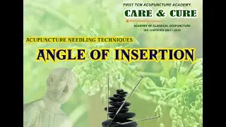 ACUPUNCTURE NEEDLING TECHNIQUE/ ANGLE OF INSERTION/ TCM ACUPUNCTURE IN TAMIL/CARE & CURE AUPUNCTURE