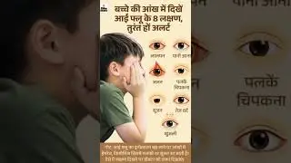 Eye Flu #eye infection #infection of eye#pink eyes#shortvideo #educationalvideo #eyes #shortsvideo