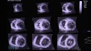 4D multi-slice imaging