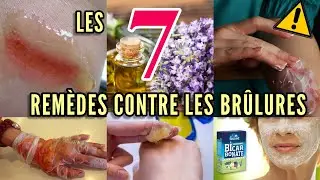 Les 7 Rem&egrave;des contre les br&ucirc;lures!