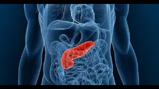 Диабет и NBS. Diabetes and NBS.
