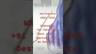 Varicocele CDVL TECH
