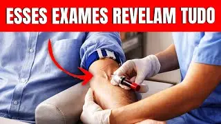 Faça esses 7 exames antes de tomar qualquer remédio para diabetes