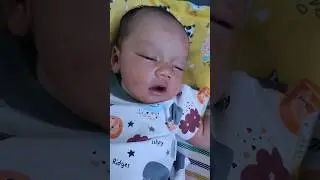 Alergi terhadap bedak tabur atau kena sawan ini? #shortsvideo #fypシ #alergy #alergi #babyel #baby