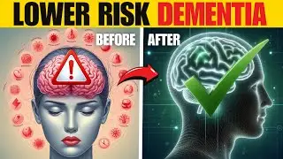 Seniors Over 60: Do These 10 Things to Prevent Dementia Naturally