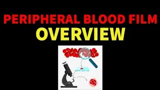 PERIPHERAL BLOOD FILM - OVERVIEW | Dr.Sonu Yadav | Pathology Kingdom | Haematology