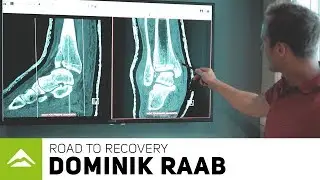 DOMINIK RAAB - ROAD TO RECOVERY