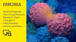 Webinar (Preview): Dynamic Quantification of Cancer Cell Metabolism Using Live-Cell Analysis