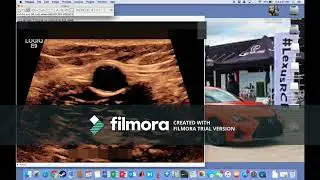 Tutorial ImageJ (Image Processing)