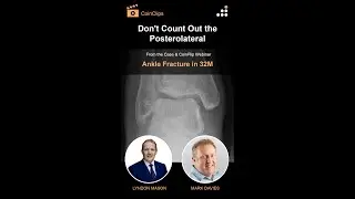 Don't Count Out the Posterolateral