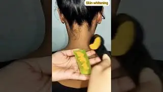Советы по отбеливанию кожи ll #tanningremove #skincare#hometips #shorts #youtubeshorts