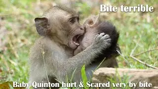 Bite Terrify ! Dakota is Beat & Bite baby Quinton seriously, Baby Quinton Hurt very strong by bite
