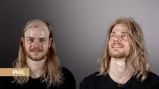 Cooler Surfer Look für Männer trotz Haarausfall - Phil aus Berlin bekommt sein Haarsystem bei O.C.