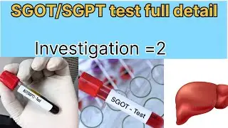 SGOT /SGPT full detail hindi main || liver function test 