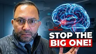 Mini Stroke (TIA): Early Signs, Treatment & How to Stop a Future Stroke