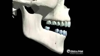 The domino effect of tooth loss