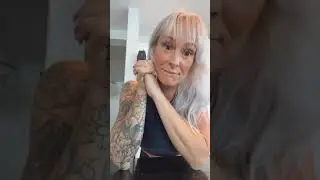 Is it a Stork Bite or MTHFR? #shorts #shortsfeed #shortsyoutube