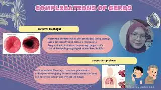 A Case Study on Gastroesophageal Reflux Disease (GERD)BIO270 &ndash; Group 5