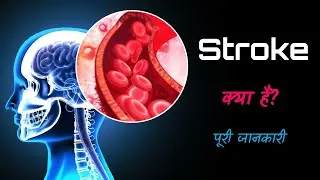 What is a Stroke with Full Information? &ndash; [Hindi] &ndash; Quick Support
