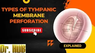 Types of tympanic membrane perforation