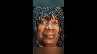 Diagnóstico de Milton Nascimento