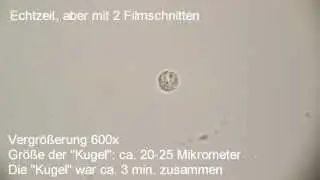 4-er Zellteilung bei Pantoffeltierchen