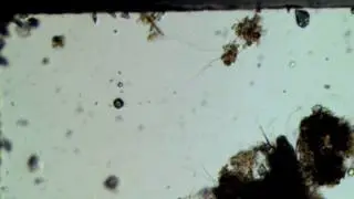 Halteria grandinella