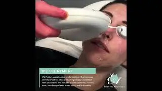 IPL Photorejuvenation