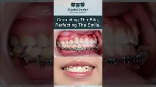 Best Dentist in Multan/ Best Dental Clinic in Multan