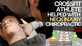 CrossFit Athlete Neck Injury Helped with Chiropractic Dr  Jordan Fairley
