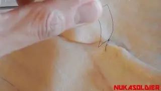 Minor Skin Surgery - How To Sew Sutures, Stitches 101 - For Beginners SHTF