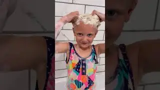 Toddler cradle cap and dandruff issues