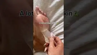 Peeling Feet | Foot Peel Mask | Baby Soft Feet | Foot Care solution | Get Rid of Dry & Callused Feet