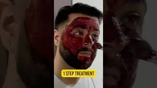 Overnight Skin Whitening Challenge: Natural Bleach with Home Remedies