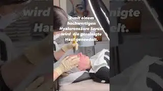 Microneedling BB Glow Behandlung die Reihenfolge #microneedling #bbglow #gesichtsreinigung #haut