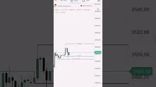 XAUUSD Gold Trade | Target Hit 1:7 Ratio 💰🔥 | No Indicator | Pure Trading
