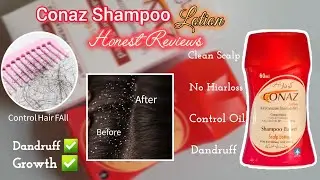 Conaz Shampoo Honest Reviews | Best Anti-dandruff Shampoo | Dose it really work