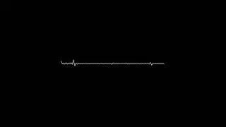 M i S S i N G S U M M E R | Prod. by Lordblessganyi