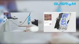 Real-Time Full Arch Scanning in Seconds | GScan IQ Intraoral Scanner Demo