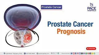 What are the Chances of Surviving Prostate Cancer? | Prostate Cancer Prognosis #prostatecancer